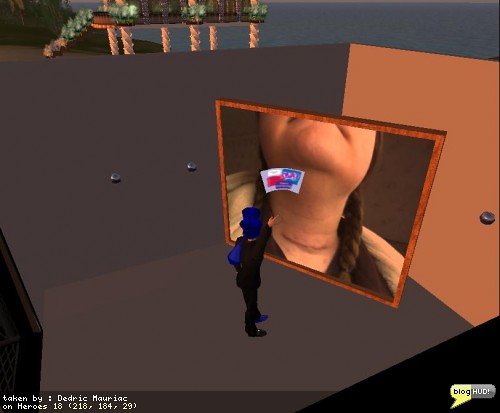 RFL of SL 2008 Scar from Incision